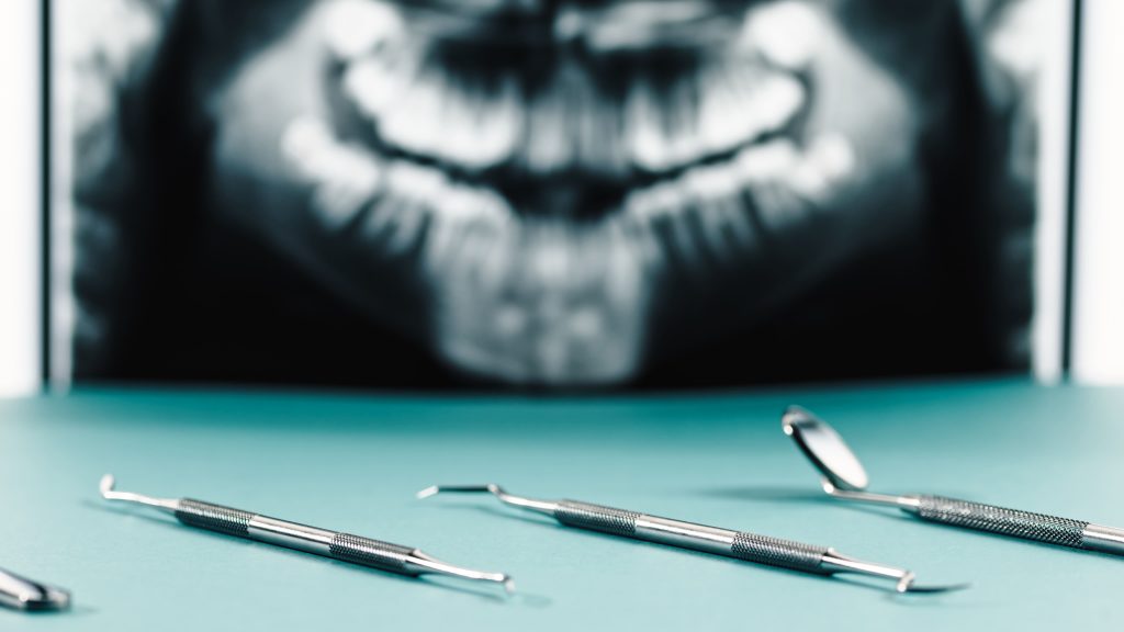dental instruments and x ray on light background 2026 03 18 04 30 17 utc