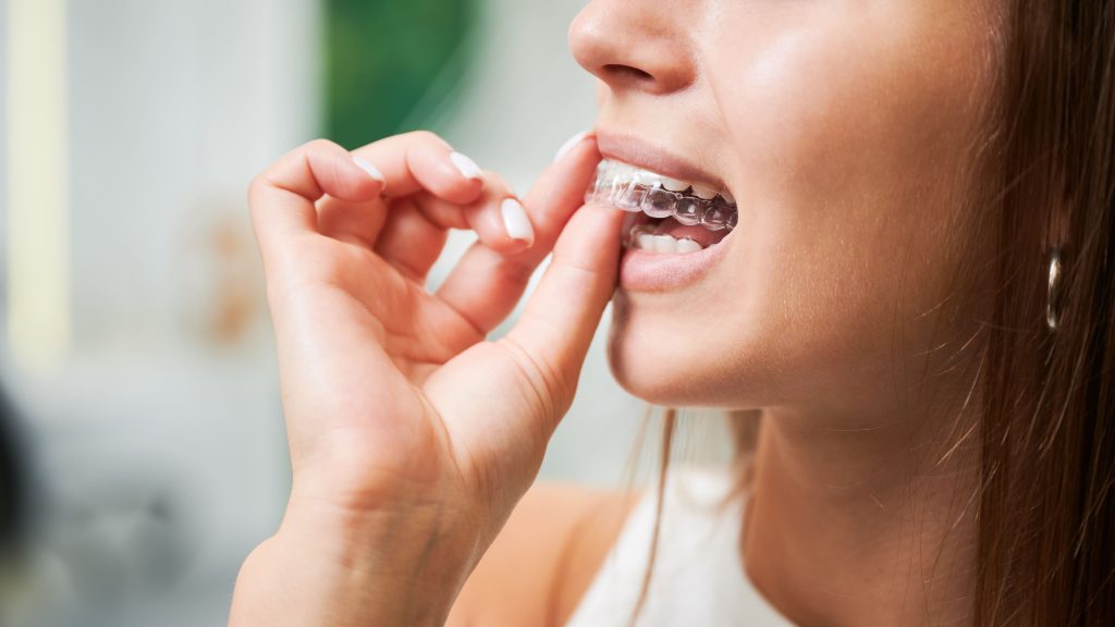 young woman puts on clear aligner in close up det 2026 06 18 16 49 06 utc